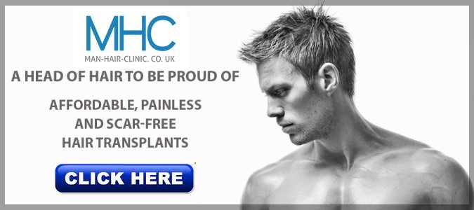 http://man-hair-clinic.co.uk/